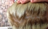 Henkel Palette 10.1 Saç Boyası Kafamın Derisini Yaktı
